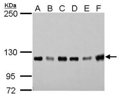 Western Blot: GEF-H1 Antibody (1132) [NBP2-43584]