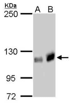 Western Blot: GEF-H1 Antibody (1132) [NBP2-43584]