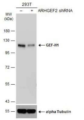 Western Blot: GEF-H1 Antibody (1132) [NBP2-43584]