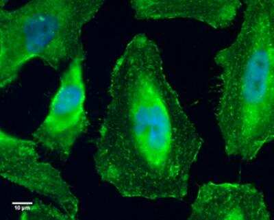 Immunocytochemistry/ Immunofluorescence: GEF-H1 Antibody (336) [NBP2-43635]