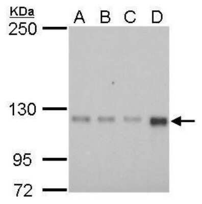 Western Blot: GEF-H1 Antibody (336) [NBP2-43635]