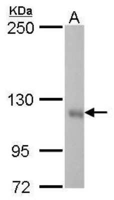 Western Blot: GEF-H1 Antibody (336) [NBP2-43635]