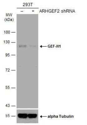 Western Blot: GEF-H1 Antibody (336) [NBP2-43635]