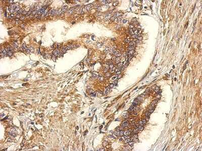 Immunohistochemistry-Paraffin: GEF-H1 Antibody [NBP2-21577]