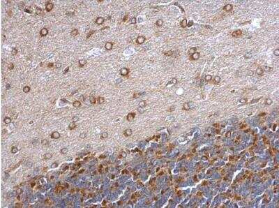 Immunohistochemistry-Paraffin: GEF-H1 Antibody [NBP2-21577]