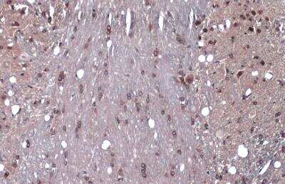 Immunohistochemistry-Paraffin: GEF-H1 Antibody [NBP2-21577]