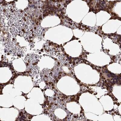 Immunohistochemistry-Paraffin: GEF-H1 Antibody [NBP2-58647]