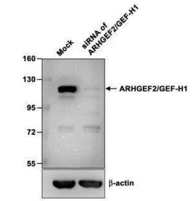 Western Blot: GEF-H1 Antibody [NBP2-21577]