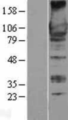 Western Blot: GEF-H1 Overexpression Lysate [NBL1-07680]