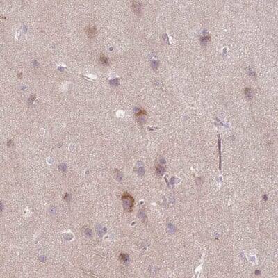 Immunohistochemistry-Paraffin: GEFT Antibody [NBP2-14309]