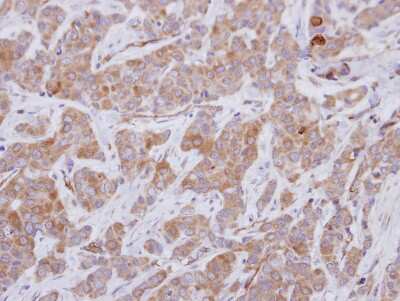 Immunohistochemistry-Paraffin: GEFT Antibody [NBP2-16636]