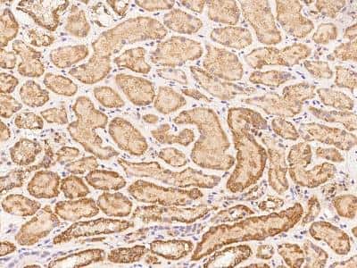 Immunohistochemistry-Paraffin: GEFT Antibody [NBP3-06354]