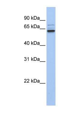 Western Blot: GEFT Antibody [NBP1-54351]