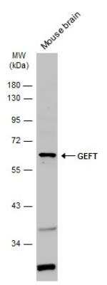 Western Blot: GEFT Antibody [NBP2-16636]