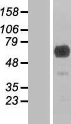 Western Blot: GEFT Overexpression Lysate [NBL1-11035]