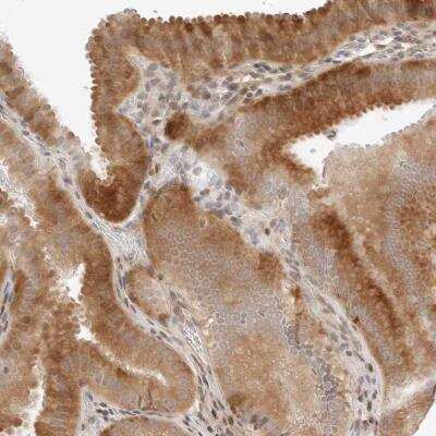 Immunohistochemistry-Paraffin: GEM Antibody [NBP1-81350]