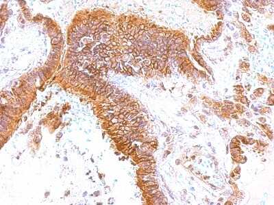 Immunohistochemistry-Paraffin: GEM Antibody [NBP1-30962]