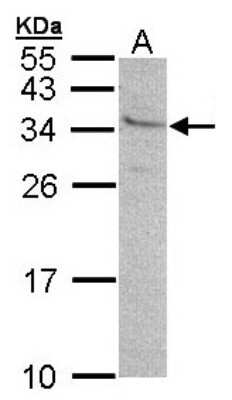 Western Blot: GEM Antibody [NBP1-30962]