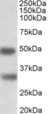 Western Blot: GEM Antibody [NBP2-26121]