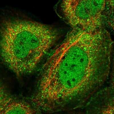 Immunocytochemistry/ Immunofluorescence: GEM Interacting Protein Antibody [NBP2-30827]