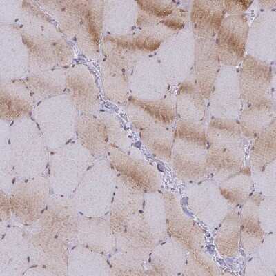 Immunohistochemistry-Paraffin: GEM Interacting Protein Antibody [NBP2-30537]
