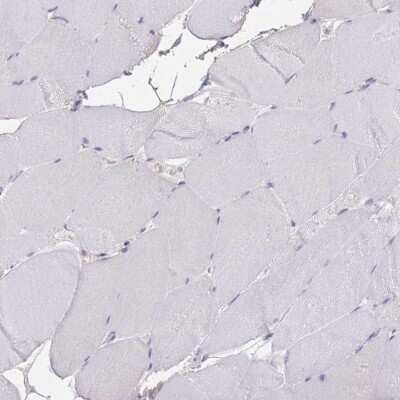 Immunohistochemistry-Paraffin: GEM Interacting Protein Antibody [NBP2-30827]