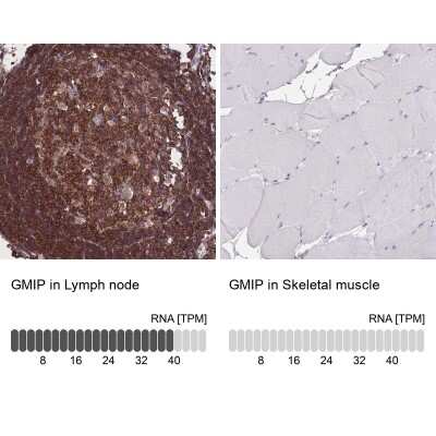 Immunohistochemistry-Paraffin: GEM Interacting Protein Antibody [NBP2-30827]