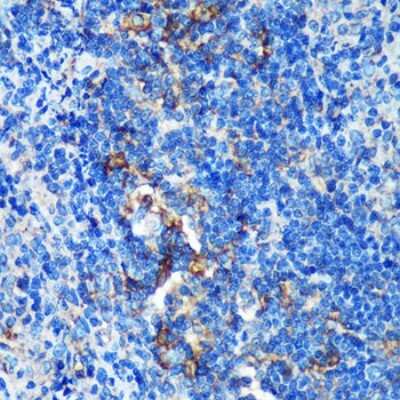Immunohistochemistry-Paraffin: GEM Interacting Protein Antibody - Azide and BSA Free [NBP3-03540]