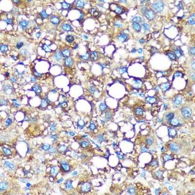 Immunohistochemistry-Paraffin: GEM Interacting Protein Antibody - Azide and BSA Free [NBP3-03540]