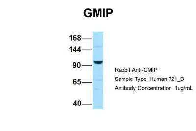 Western Blot: GEM Interacting Protein Antibody [NBP2-84967]