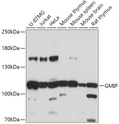 Western Blot: GEM Interacting Protein AntibodyAzide and BSA Free [NBP3-03540]