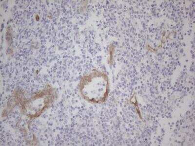 Immunohistochemistry: GEMIN2 Antibody (OTI4C11) [NBP2-45831]