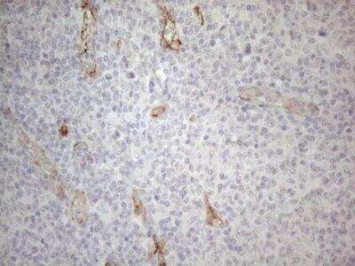Immunohistochemistry: GEMIN2 Antibody (OTI4C11) [NBP2-45831]