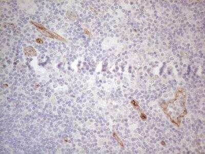 Immunohistochemistry: GEMIN2 Antibody (OTI4C11) [NBP2-45831]