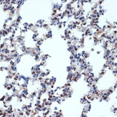 Immunohistochemistry-Paraffin: GEMIN2 Antibody (9C8K3) [NBP3-15717]