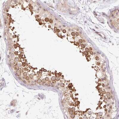 Immunohistochemistry-Paraffin: GEMIN2 Antibody [NBP2-38553]