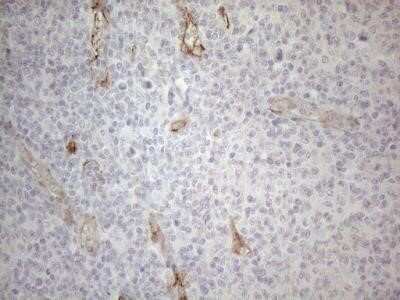 Immunohistochemistry: GEMIN2 Antibody (OTI4C11) - Azide and BSA Free [NBP2-71374]