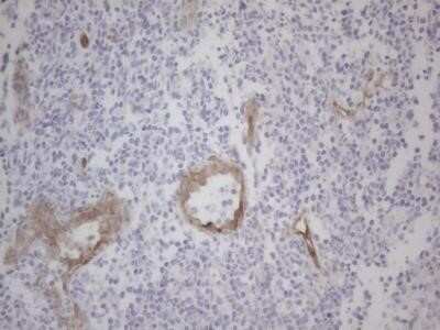 Immunohistochemistry: GEMIN2 Antibody (OTI4C11) - Azide and BSA Free [NBP2-71374]