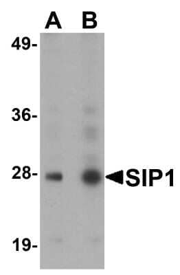 Western Blot: GEMIN2 AntibodyBSA Free [NBP1-77177]