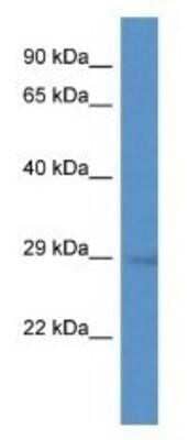 Western Blot: GEMIN2 Antibody [NBP1-80445]