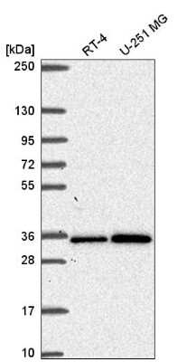 Western Blot: GEMIN2 Antibody [NBP2-55393]