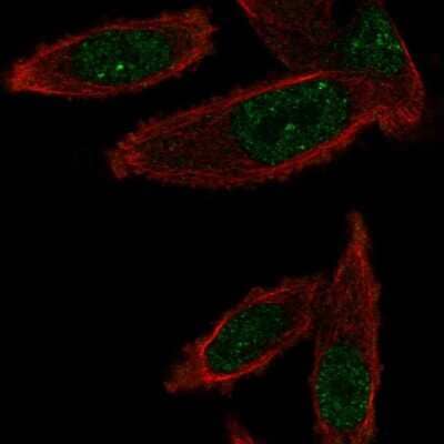 Immunocytochemistry/ Immunofluorescence: GEMIN6 Antibody [NBP2-58682]