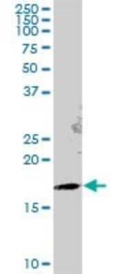 Western Blot: GEMIN6 Antibody [H00079833-B01P]