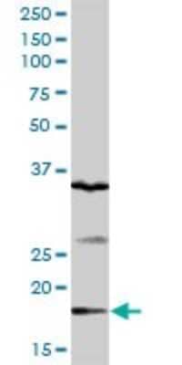 Western Blot: GEMIN6 Antibody [H00079833-D01P]