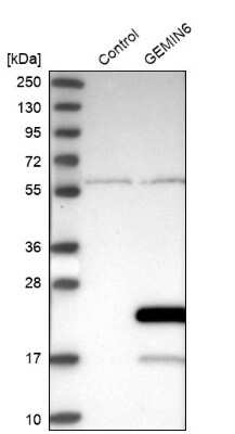 Western Blot: GEMIN6 Antibody [NBP1-82075]