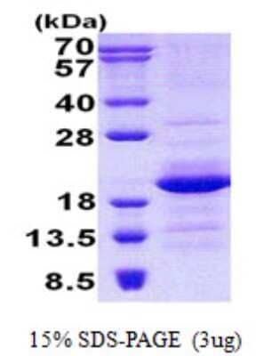 SDS-PAGE: Recombinant Human GEMIN6 His Protein [NBP2-23073]