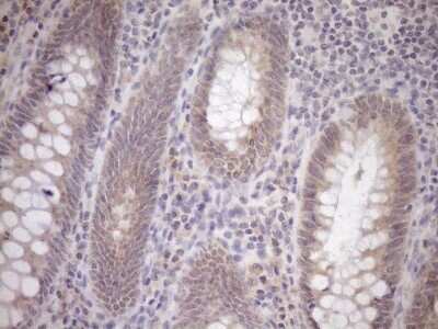 Immunohistochemistry: GEMIN8 Antibody (OTI1E5) [NBP2-45832]