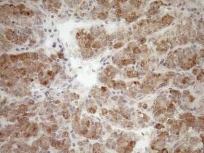 Immunohistochemistry: GEMIN8 Antibody (OTI1E5) [NBP2-45832]