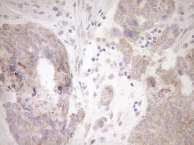 Immunohistochemistry: GEMIN8 Antibody (OTI1E5) [NBP2-45832]