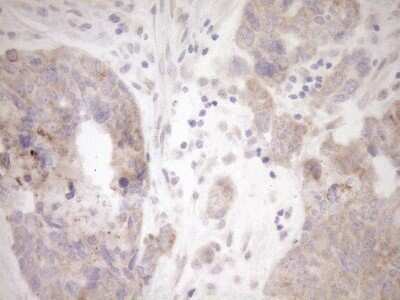 Immunohistochemistry: GEMIN8 Antibody (OTI1E5) - Azide and BSA Free [NBP2-71977]